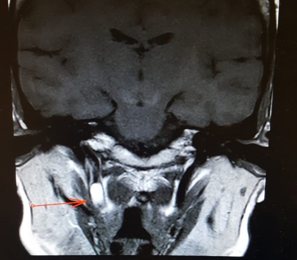 צילום הרנטגן בבית חולים לניאדו חייה של אשה ניצלו בזכות טכנאית רנטגן